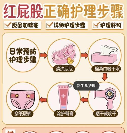 屁股花浇水方法是什么？如何正确进行浇水？