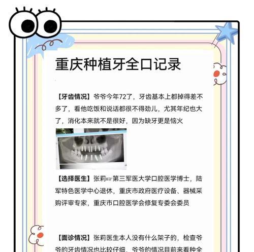 种植牙经验丰富的医生有哪些？如何选择合适的种植牙医生？